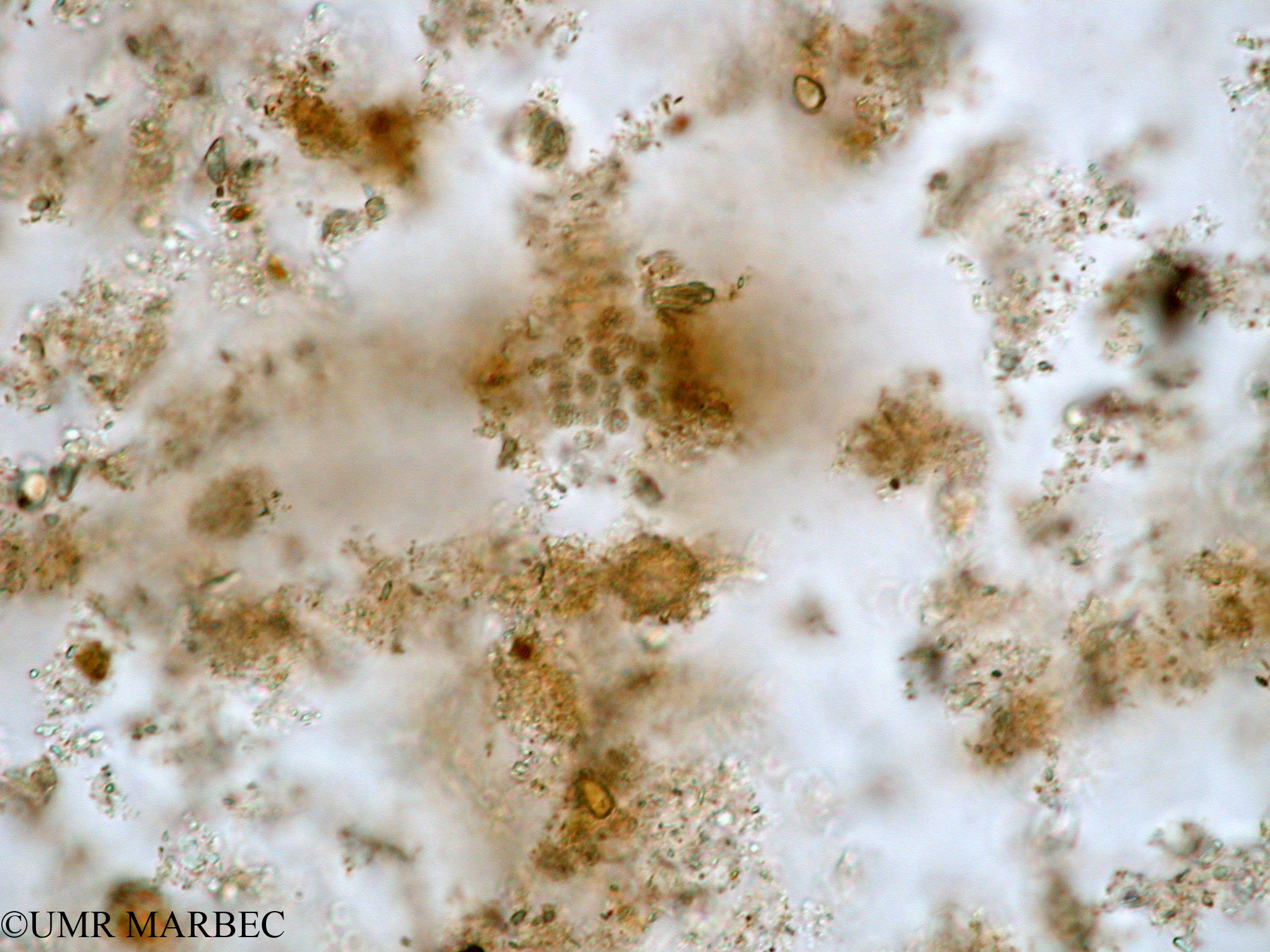 phyto/Tulear Lagoon/all/ICAR2 Avril 2008/Microcystis sp (Microscystis wesenbergii)(copy).jpg